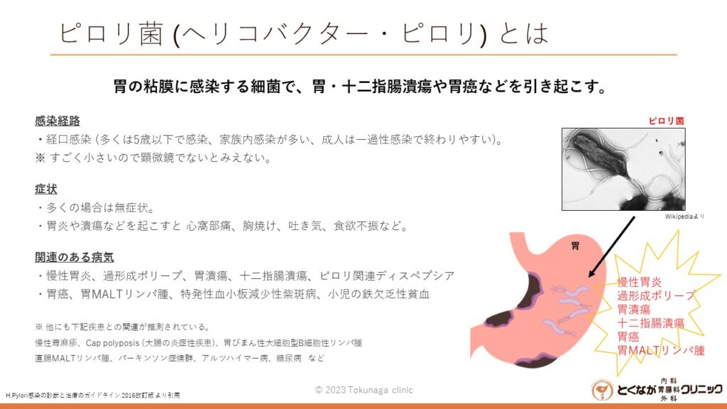 ピロリ菌 感染症 のイメージ画像